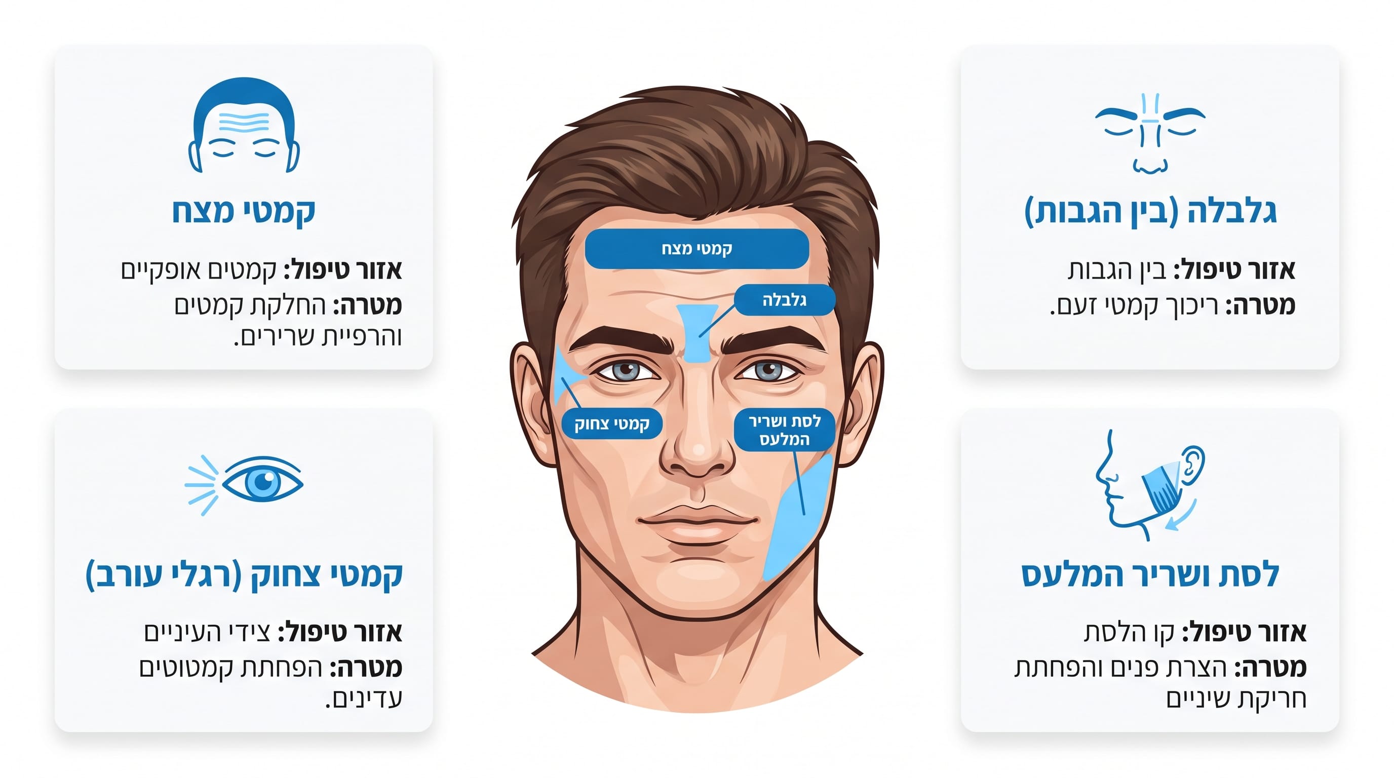 מיפוי אזורי טיפול בבוטוקס אצל גברים כולל צוואר ולסת