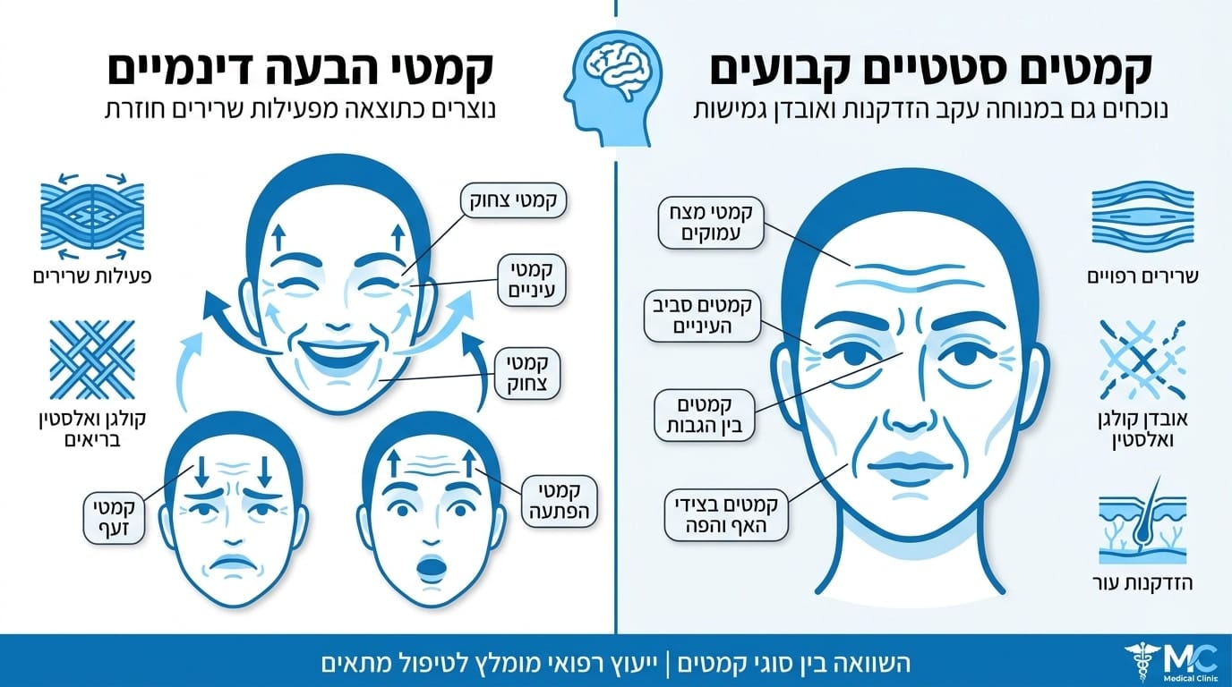 כמה זמן מחזיק בוטוקס וכל מה שחשוב לדעת